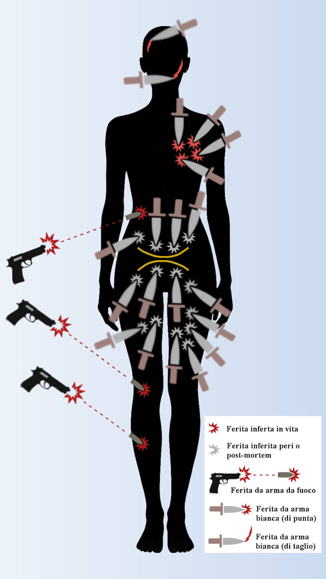 Distribuzione delle principali ferite sul corpo di Stefania Pettini